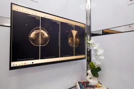 Ação faz parte do programa Rastreio de Câncer de Mama para intensificar o diagnóstico precoce da neoplasia na Bahia