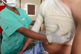 TRATAMENTO QUEIMADOS HGE - Mateus Pereira GovBA (4)