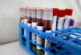 Semana do Doador: Hemoba incentiva doação de sangue com programação especial