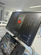 Hospital de Itaberaba recebe mais um aparelho de ultrassom e amplia assistência