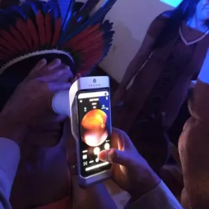 Telessaúde Bahia alcança a marca de 1 milhão de laudos emitidos por telediagnóstico