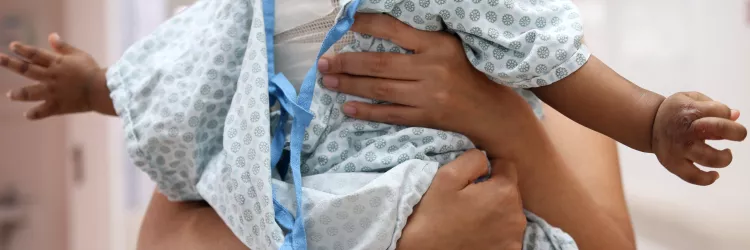 Bahia reforça rede de saúde para atender vítimas de queimaduras no São João. Centro de Tratamento de Queimados/HGE