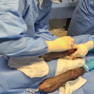 Lobo-guará atropelado no Oeste da Bahia passa por cirurgia após ser resgatado pelo Inema