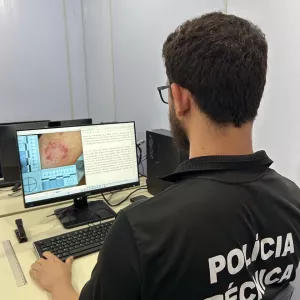 Peritos Odonto-Legais realizam exames nos circuitos do Carnaval 