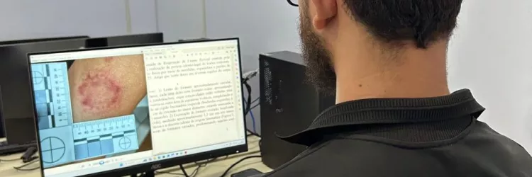 Peritos Odonto-Legais realizam exames nos circuitos do Carnaval 