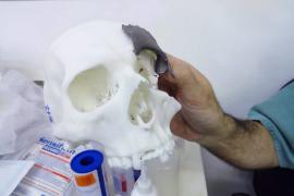noticias_protese3d