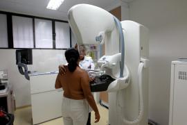 noticias_antonio_goncalves_mamografia