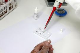 noticias_teste_rapidozikavirus