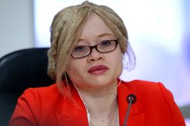 Em reunião com a ONU, Governo do Estado anuncia política de saúde para albinos (6)