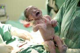 Reanimação Neonatal