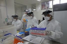Bahia passa a ter capacidade para realizar mil testes diários da Covid-19 (23)