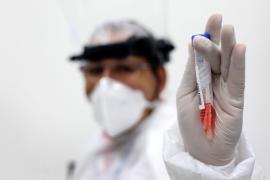 Bahia passa a ter capacidade para realizar mil testes diários da Covid-19 (5)