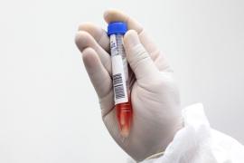 Bahia passa a ter capacidade para realizar mil testes diários da Covid-19 (6)