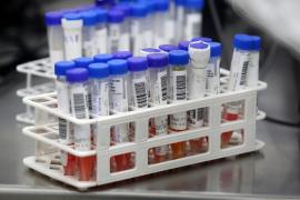 Bahia passa a ter capacidade para realizar mil testes diários da Covid-19 (7)