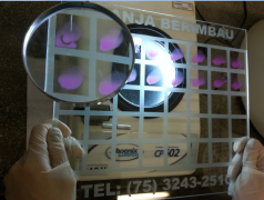 Prova de diagnostico brucelose (AAT) (1).png