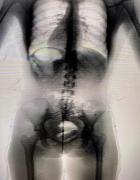 Irecê apreensão no Body Scan 3.jpg