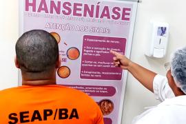 zzzzzz Serrinha hanseniase 1.jpg